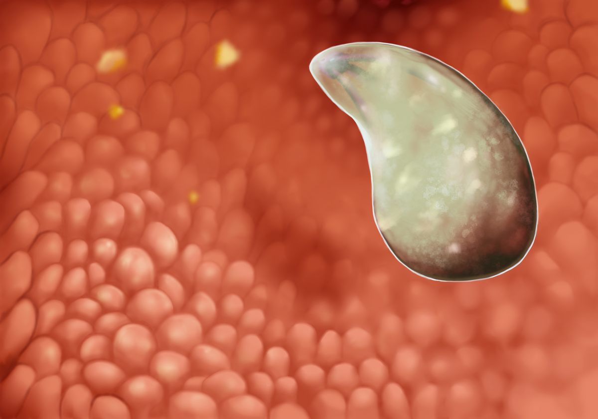 toxoplasma.jpg